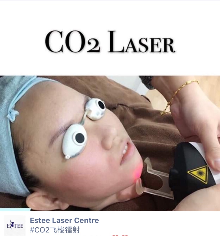 [Review] – Estee Laser Centre in Johor Bahru – Random snippets of a hobo